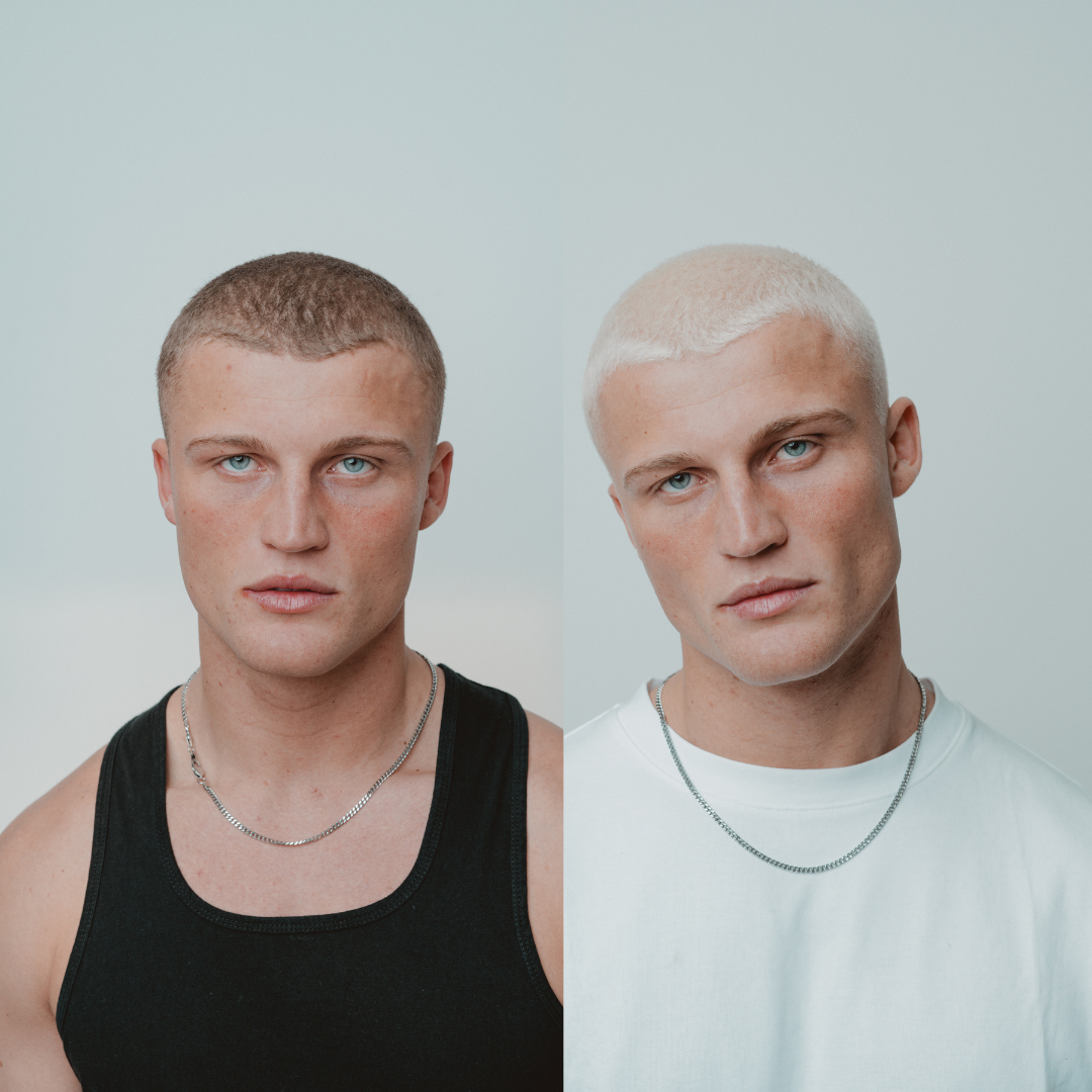 Bleaching Kit x 1